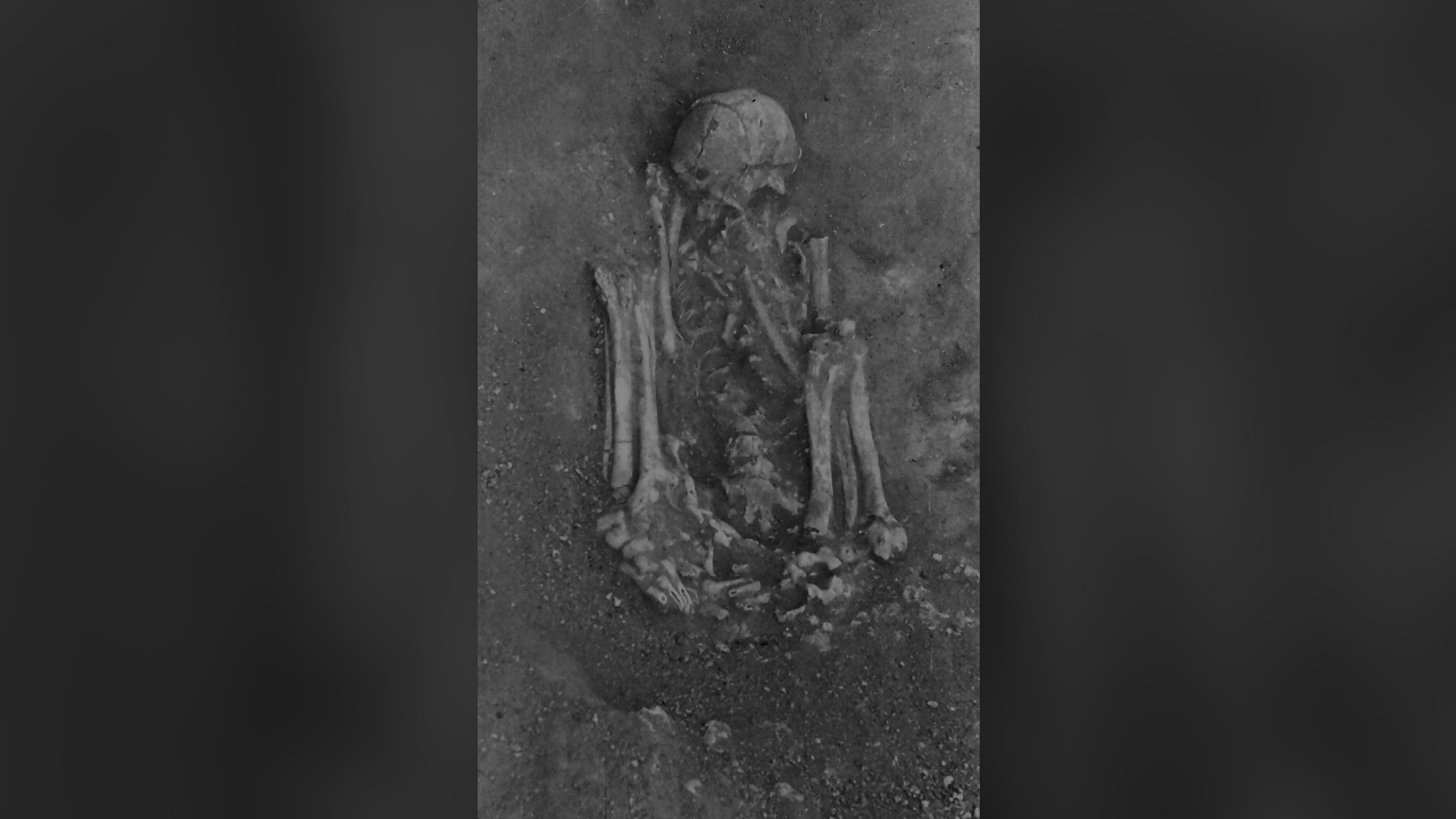 Photographs of one of the skeletons excavated from an archaeological site in the Sado Valley showed signs it had been mummified before it was buried about 8000 years ago.