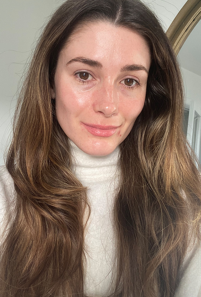 Eleanor after using the Dermalux LED Mask