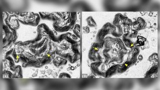 Lidar imagery shows how the hills were changed through quarrying by the Maya.