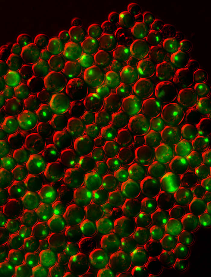 protein clumping plays a role in many human diseases