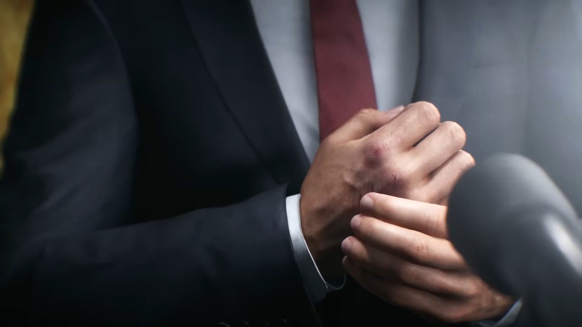 A man in a suit cradles a wounded hand in his other one
