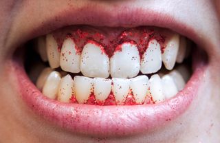 red glitter on teeth