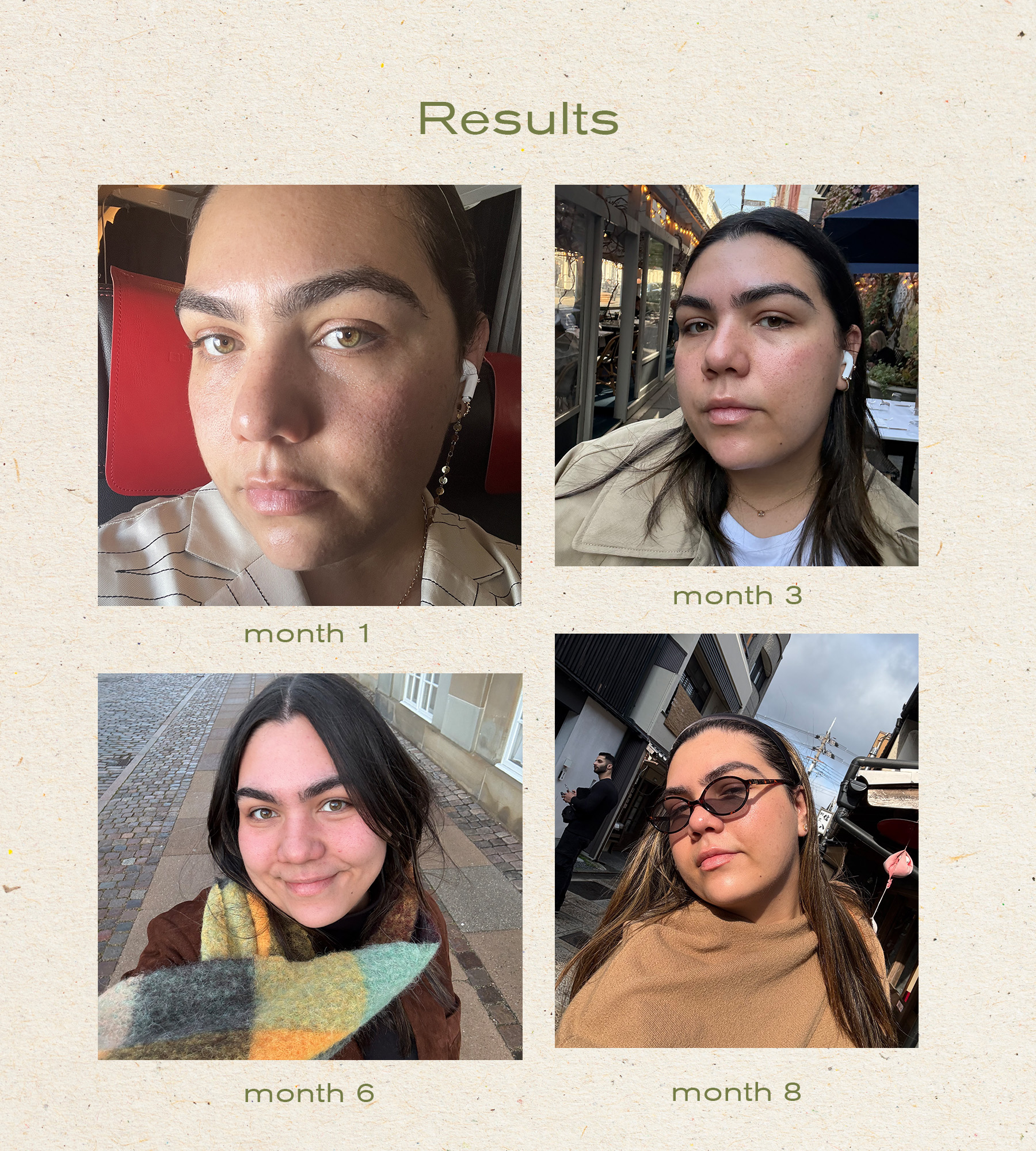 Photos of editor Ana Escalante and her skincare routine and progress photos throughout her engagement skincare process.