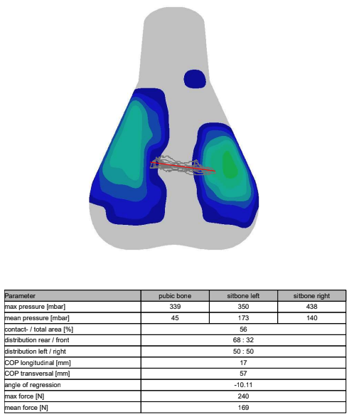 A visual output of saddle pressure mapping