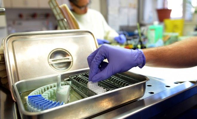 Biologists use tissue samples for cancer research.