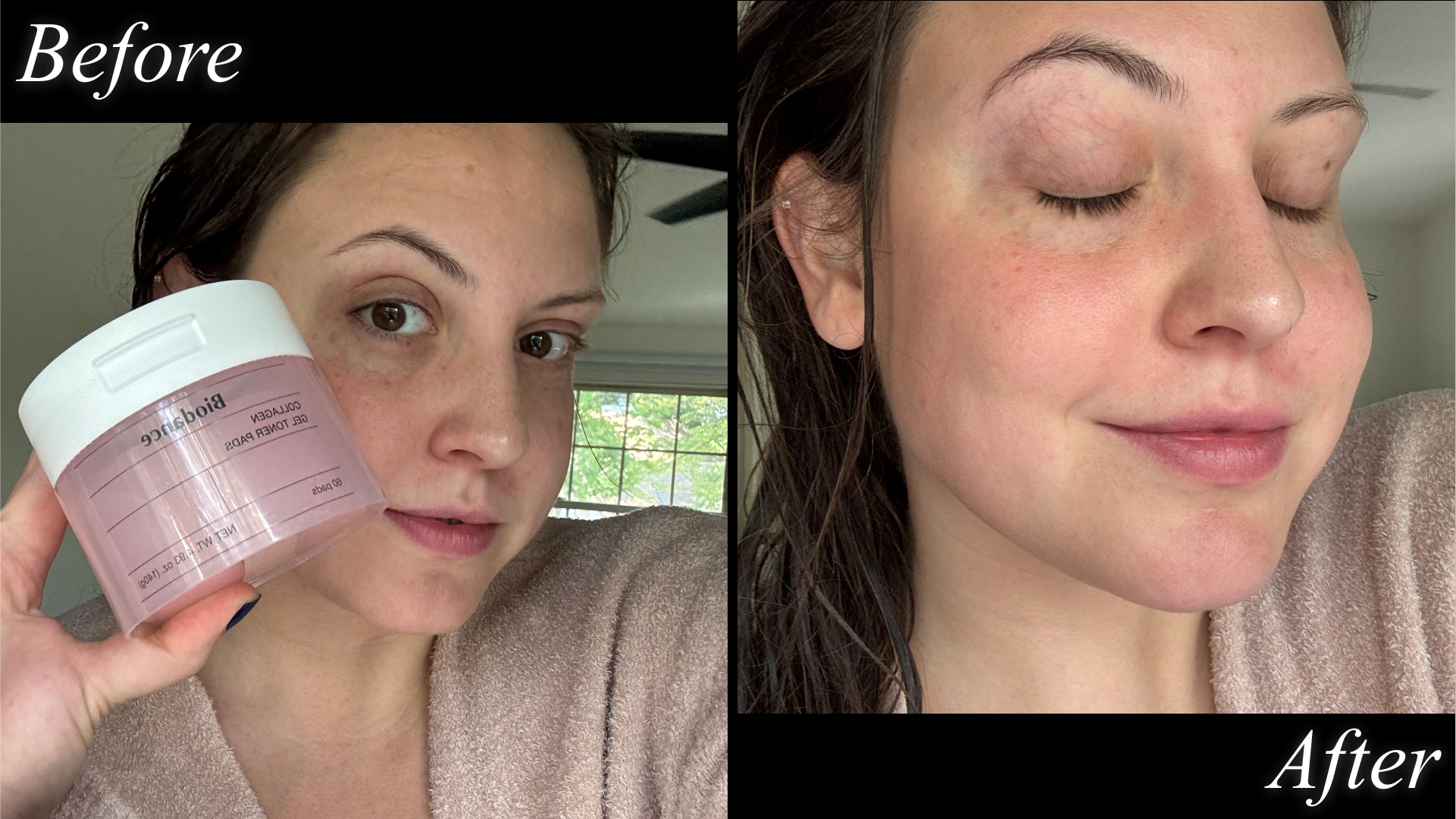 Sophia Vilensky pictured before and after testing Biodance Collagen Gel Toner Pads.