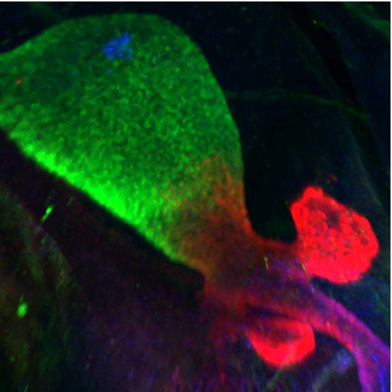 Image Gallery: Miniature Human Stomachs | Live Science