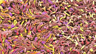 electron micrograph of Escherichia coli highlighted with red, yellow, and pink color