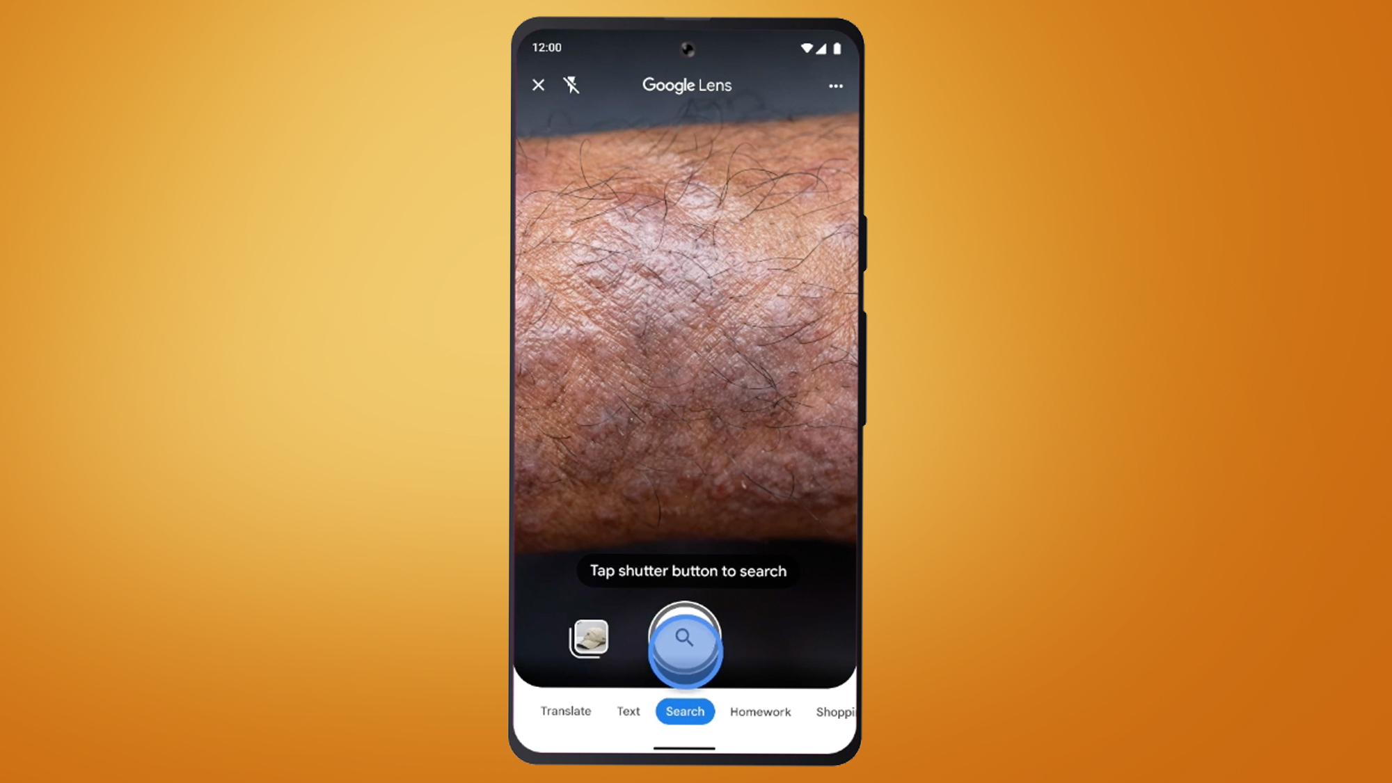 A phone screen on an orange background showing a Google Lens search for a skin condition