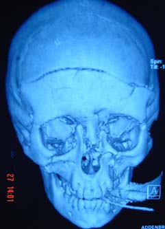 Xrays.jpg
