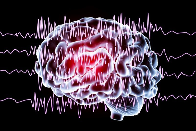 An illustration of the brain and encephalography during a seizure attack