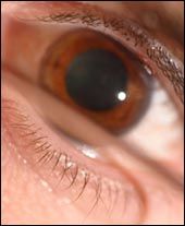 eye.jpg