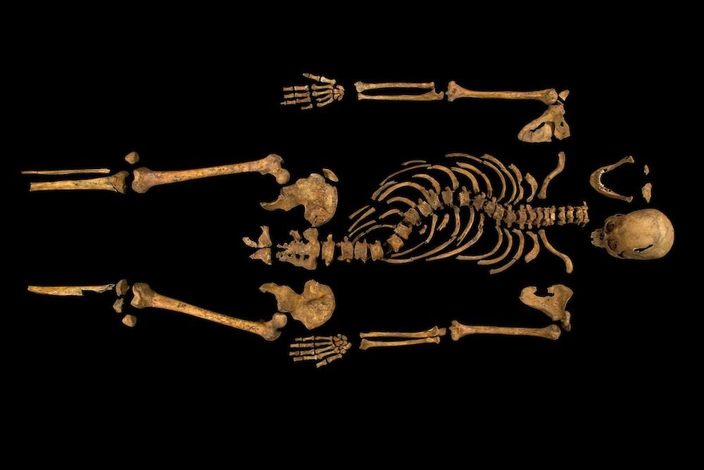 How Twisted Was King Richard Iii S Spine New Models Reveal