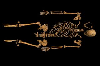 The skeleton of Richard III, showing the curve in his spine.
