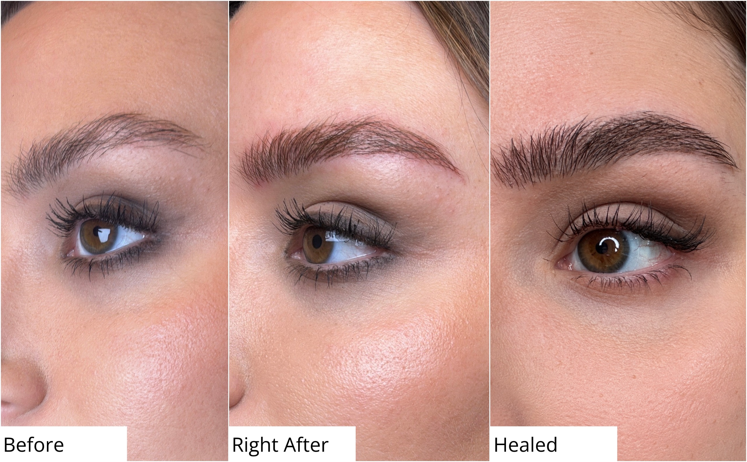 before, right after, and healed nanobrow treatment zoomed in on the eyebrow