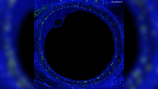 Fluorescent microscope image showing a big black circle taking up most of the image with a small black oval circle at one of the inner points of the circle. Both circles are outlined in blue with yellow dots around the large disc