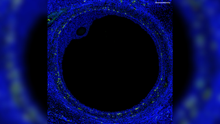Fluorescent microscope image showing a big black circle taking up most of the image with a small black oval circle at one of the inner points of the circle. Both circles are outlined in blue with yellow dots around the large disc