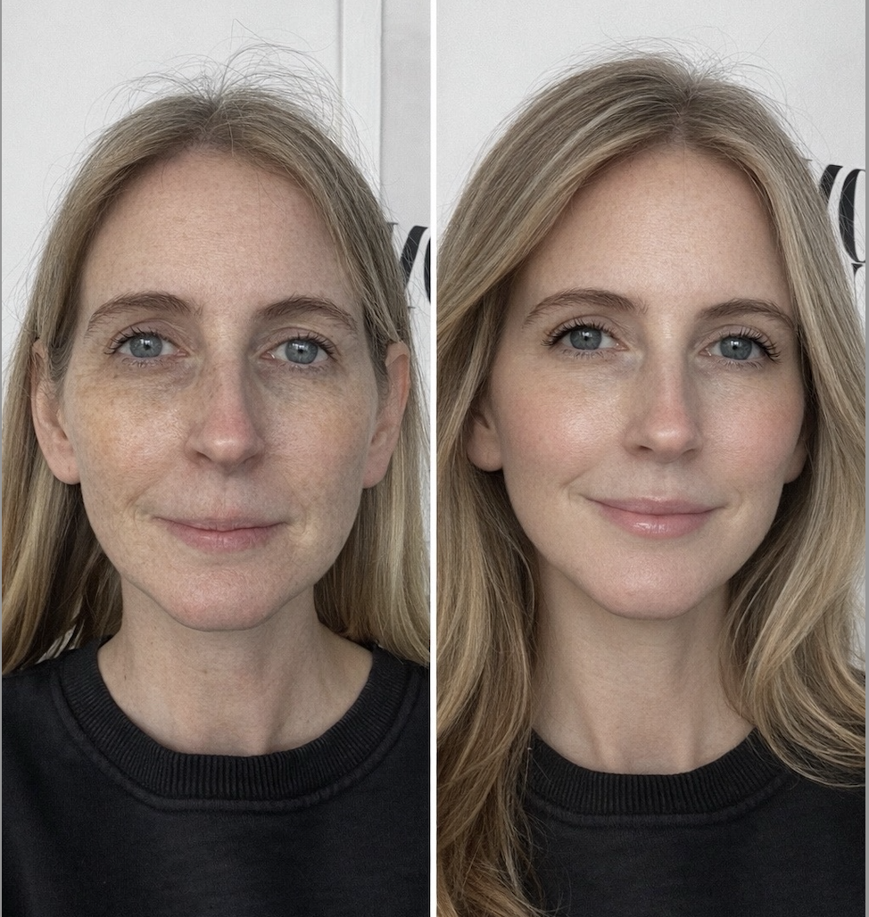AI makeover, skin treatments 2026
