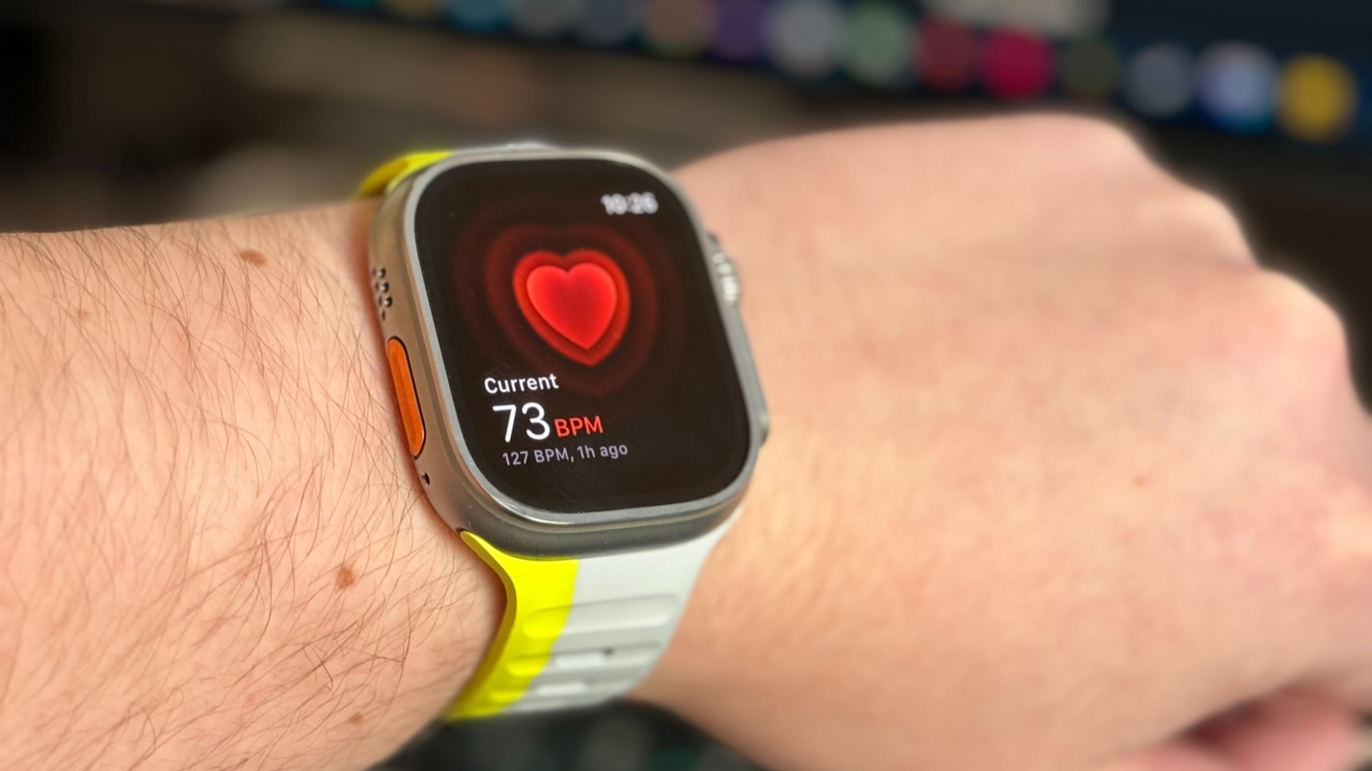 Apple Watch owner credits Apple Watch with helping him understand how mental health affects his body, emails Tim Cook to thank him
