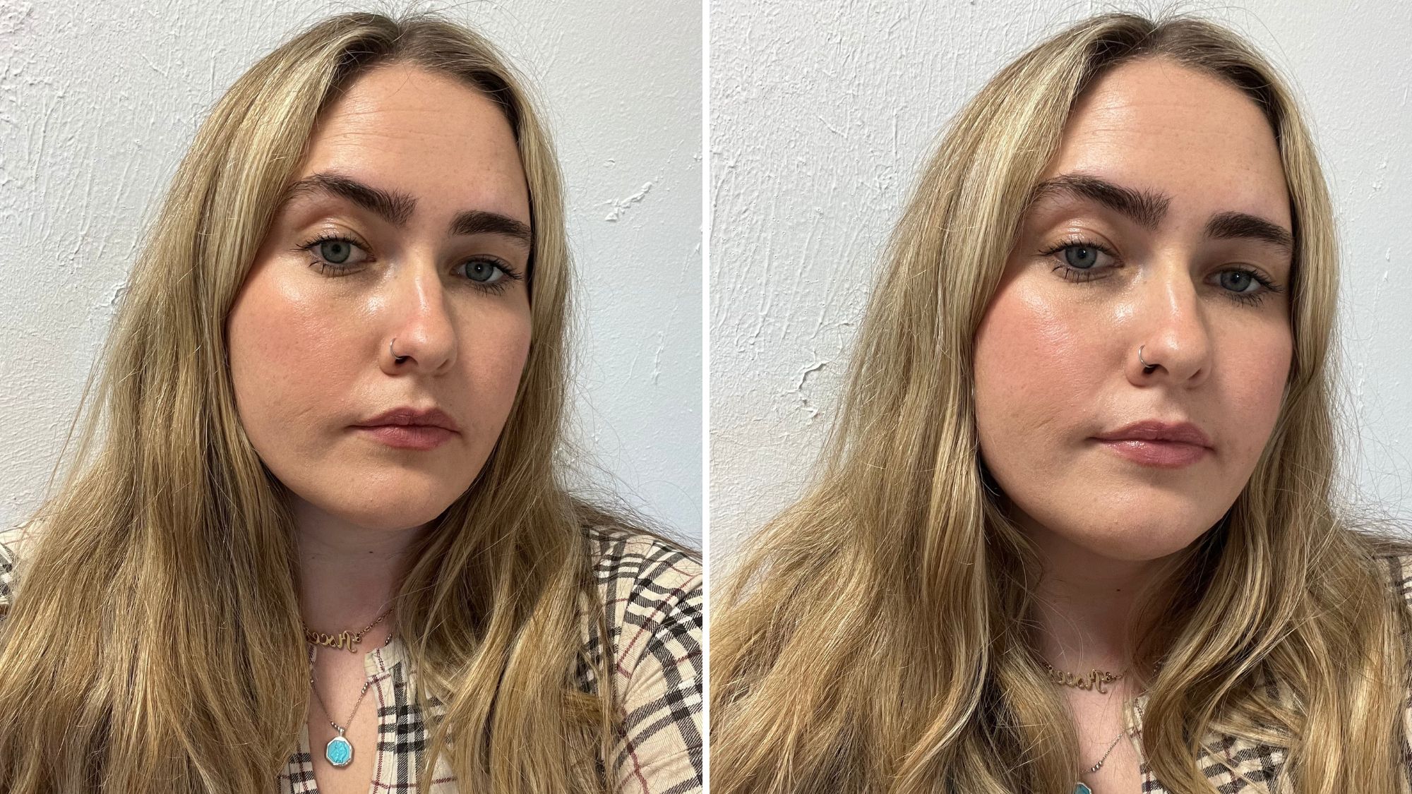 before vs after using mz skin lip perfector