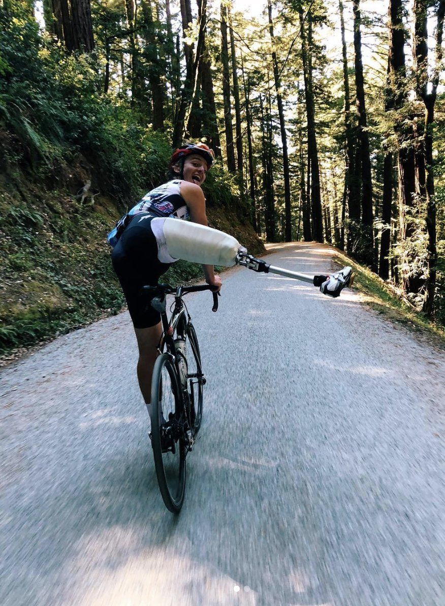 Adrien Costa shows off his new prosthetic while he's out riding