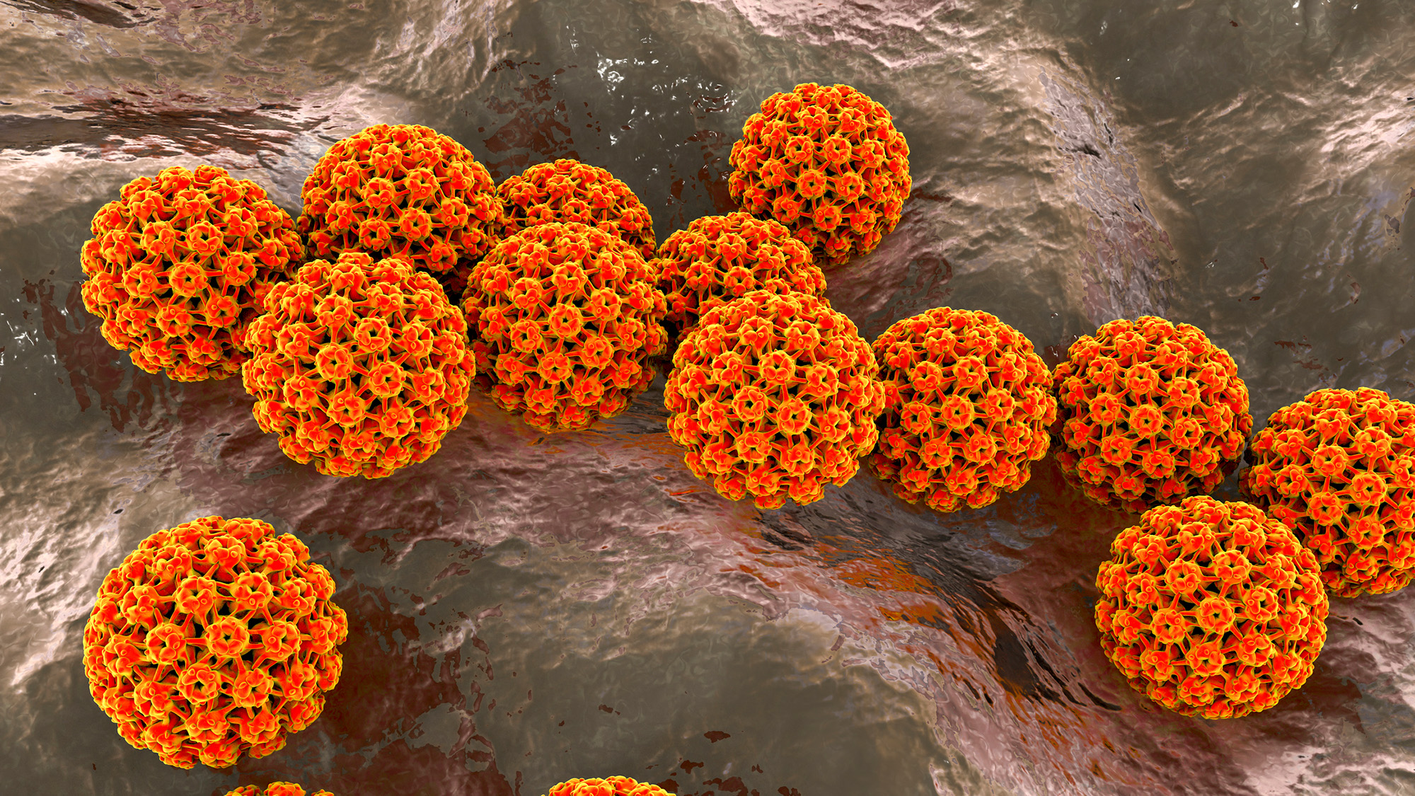 A series of orange spheres on a bumpy surface.