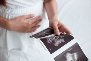 A pregnant woman holding her ultrasound scan result trying to use it for baby gender predictor tests at home.