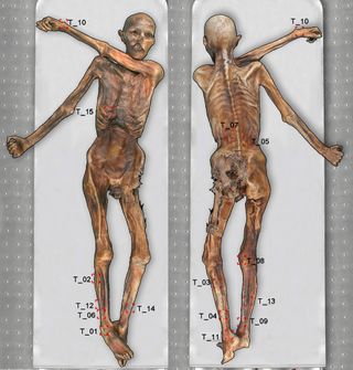 A diagram of Ötzi showing the locations of his tattoos. The researchers are the first to identify tattoo 15, on the mummy’s right ribcage.