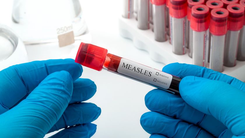 Surgeon holding a sample for testing for measles.