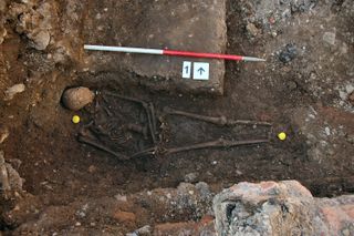 The remains of King Richard III, showing a curved spine and signs of battle trauma.