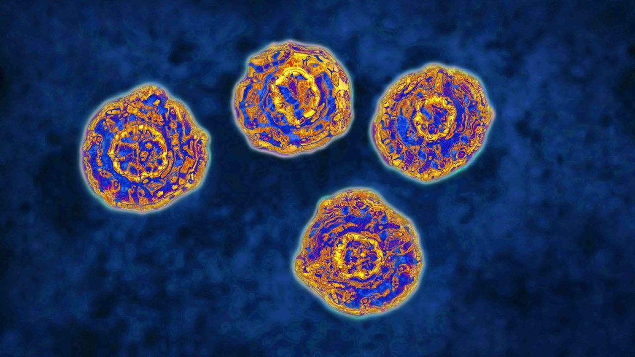 Hepatitis C virus