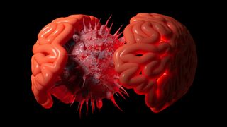 A computer-generated conceptual image of the coronavirus inside a Human Brain