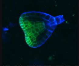 This Arabidopsis embryo begins to polarize so its top half will form a shoot and the bottom half will send out roots. Any error in the carefully orchestrated plan can lead to major defects in the plant. Because humans and animals have similar gene networks that coordinate development, studying such polarity could help us better understand human development.