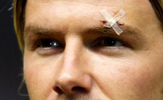 A close-up of David Beckham's face, with Steri-Strips over a cut above his left eyebrow, sustained by being struck with a boot kicked by Manchester United manager Sir Alex Ferguson in the dressing room, February 2003