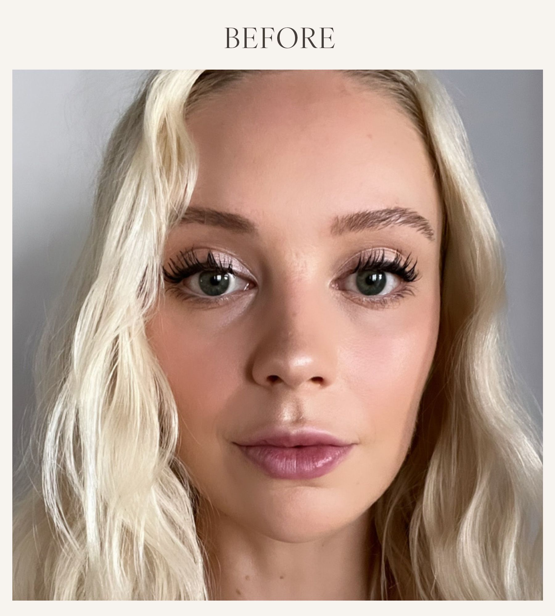 Before photo of Erin Jahns testing the e.l.f. lip plumper