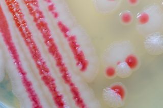Serratia marcescens is a species of rod-shaped gram-negative bacteria in the family Enterobacteriaceae for Laboratory microbiology