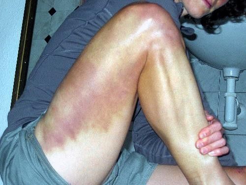 Ouch!