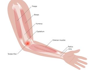 Diagram of a person's arm