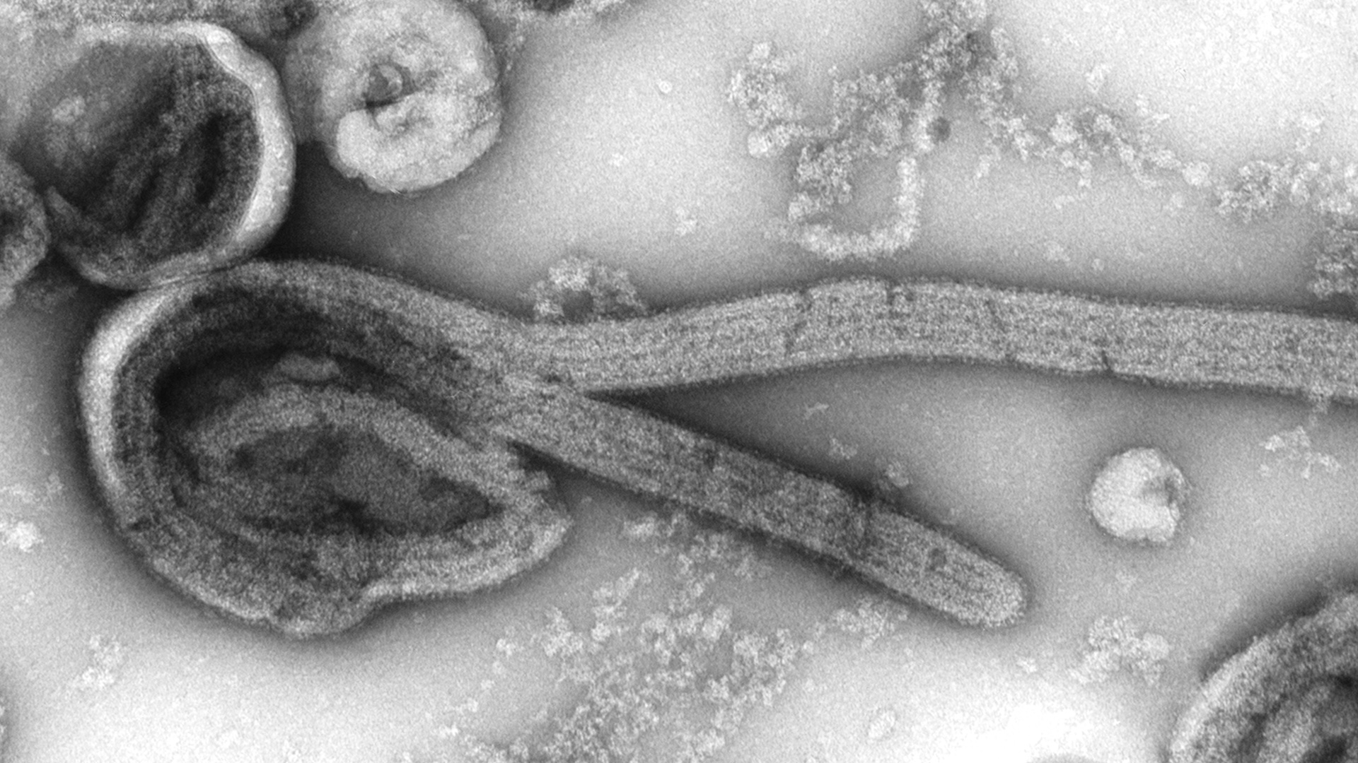 an electron microscopic image of an isolate of Ebola virus. The internal structures of the filamentous particle are visible, including the nucleocapsid and other structural viral proteins, and the outer viral envelope is covered with surface projections.