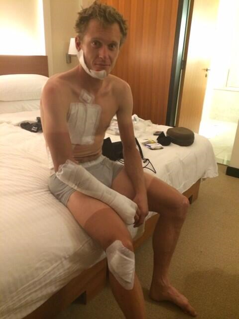 A bandaged Matti Breschel post-crash