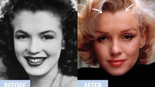 Did Marilyn Monroe have plastic surgery?