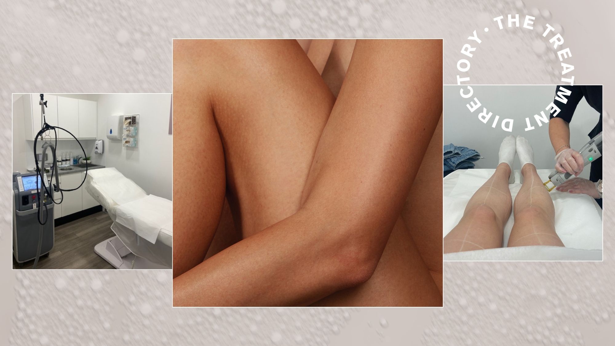 A collage of laser hair removal pictures, including pictures during treatment and the treatment room at Laser Clinics