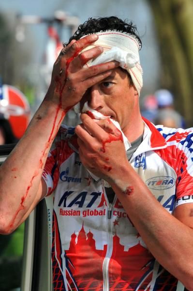 Leif Hoste (Katusha) was a frightful sight after his crash.