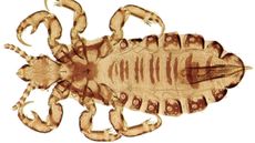 A close up picture of a human head louse.
