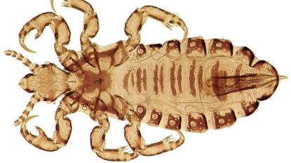 A close up picture of a human head louse.