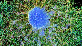 Marmoset embryonic stem cells forming neurons.