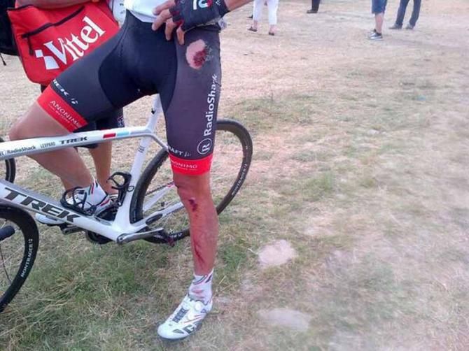 Andreas Kl&ouml;den (RadioShack-Leopard) shows off his crash wound