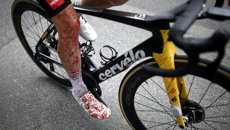 Steven Kruijswijk after his injury on stage three of the 2021 Tour de France