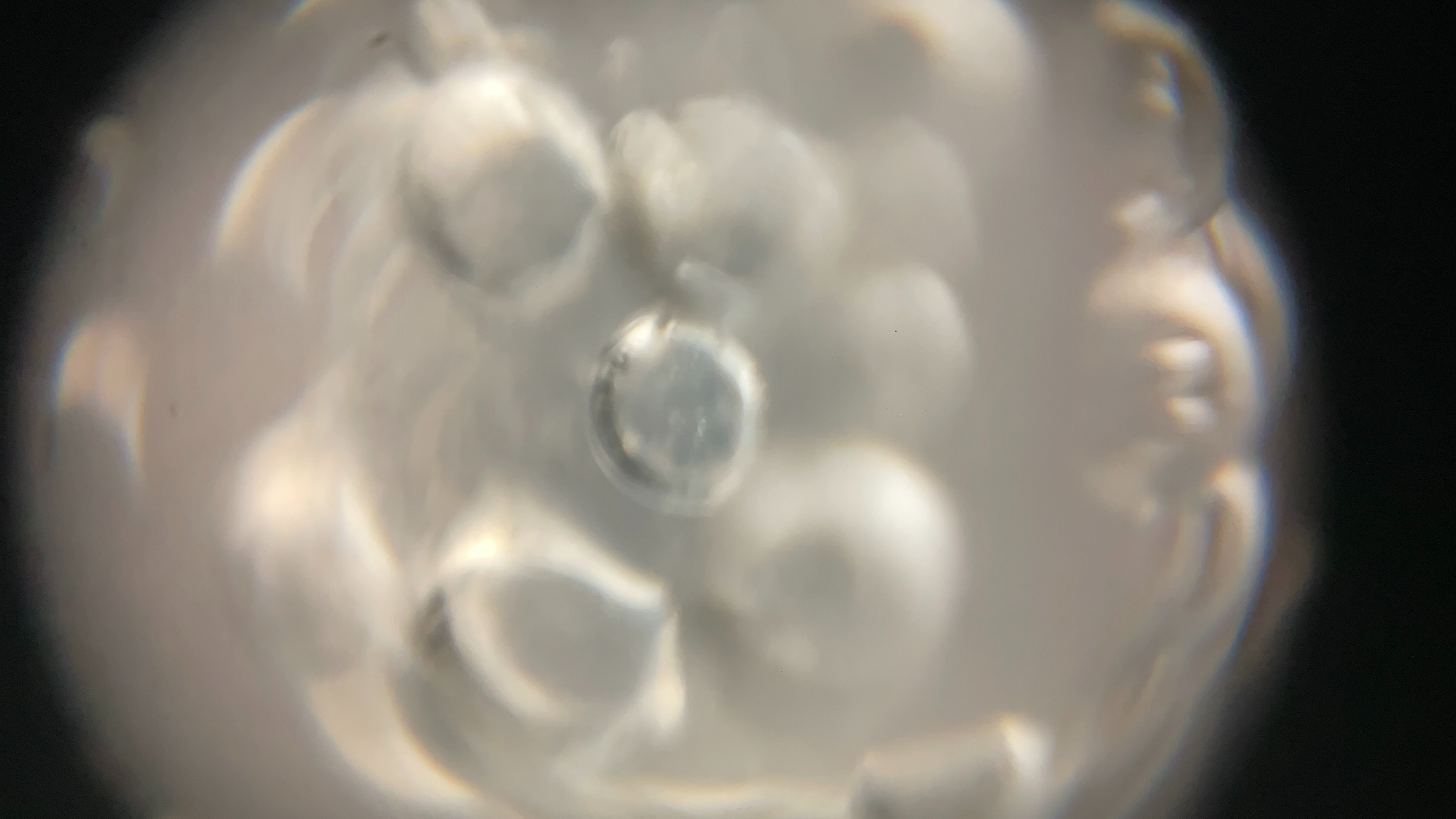 iMicro Q3p fingertip smartphone microscope