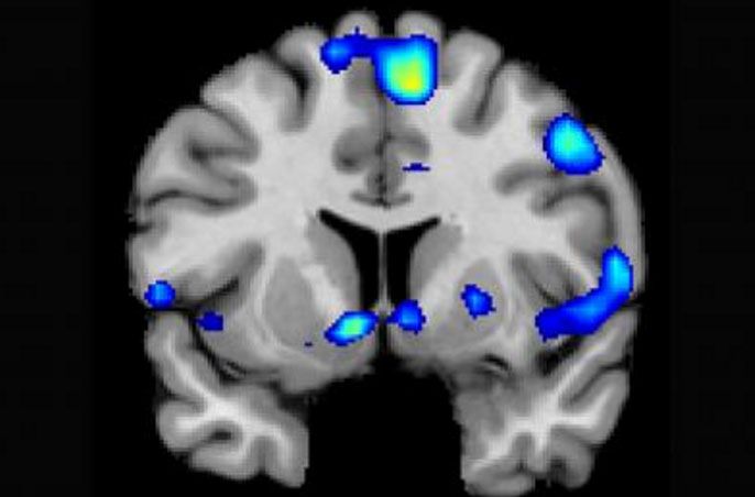 An image of brain areas activated when an individual experiences spiritual feelings.